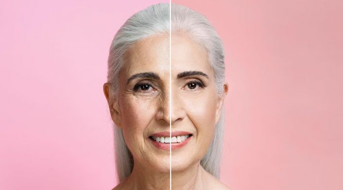 Botoks Öncesi ve Sonrası botoks öncesi ve sonrası