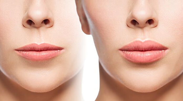 İzmir’de En İyi Botoks ve Dolgu Yapan Yerler izmir'de en iyi botoks ve dolgu yapan yerler